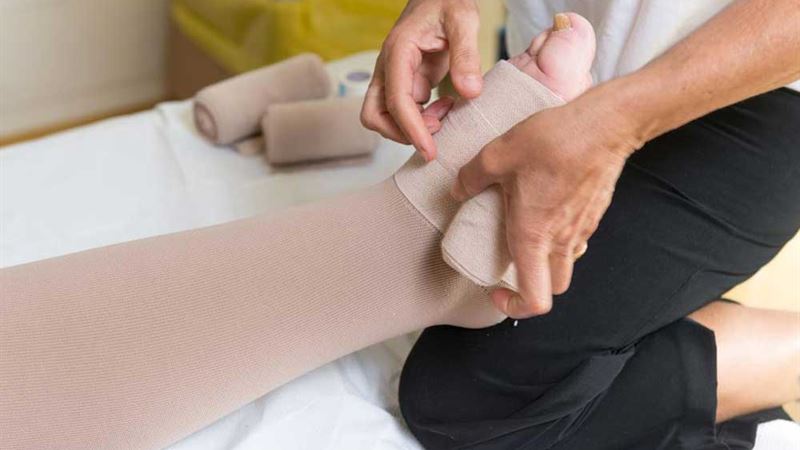 Understanding Leg Swelling: Causes, Symptoms, and Effective Treatments