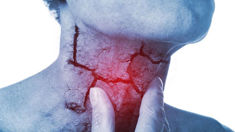 Comprehensive Guide to Common Head and Neck Cancers and Their Symptoms