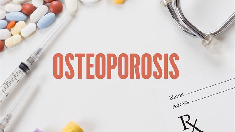 Comprehensive Guide to Managing Osteoporosis Effectively