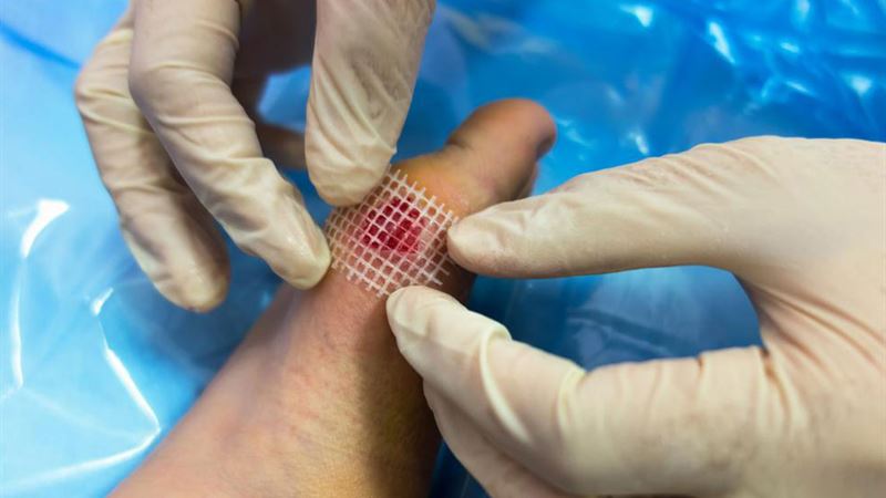 Comprehensive Guide to Shingles Treatment and Relief Strategies