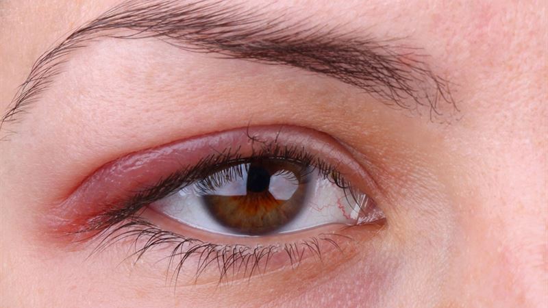 Comprehensive Guide to the Top 3 Eye Conditions Impacting Vision and Eye Health