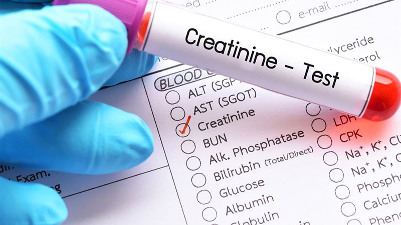 Comprehensive Guide to Interpreting Creatinine Levels and Kidney Function Tests