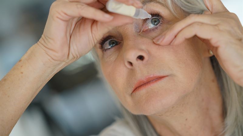 Comprehensive Guide to Understanding and Managing Dry Eyes