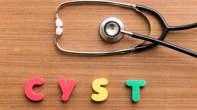 Comprehensive Treatment Strategies for Sebaceous Cysts: Effective Methods to Manage and Cure