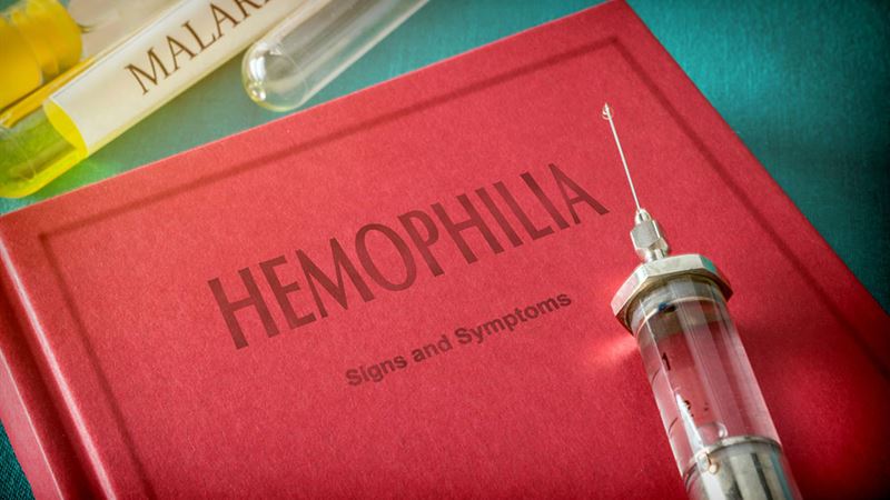 Understanding Hemophilia: Key Symptoms and Severity Levels