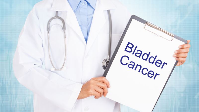 Comprehensive Guide to Bladder Cancer: Diagnosis, Grades, and Treatment Strategies