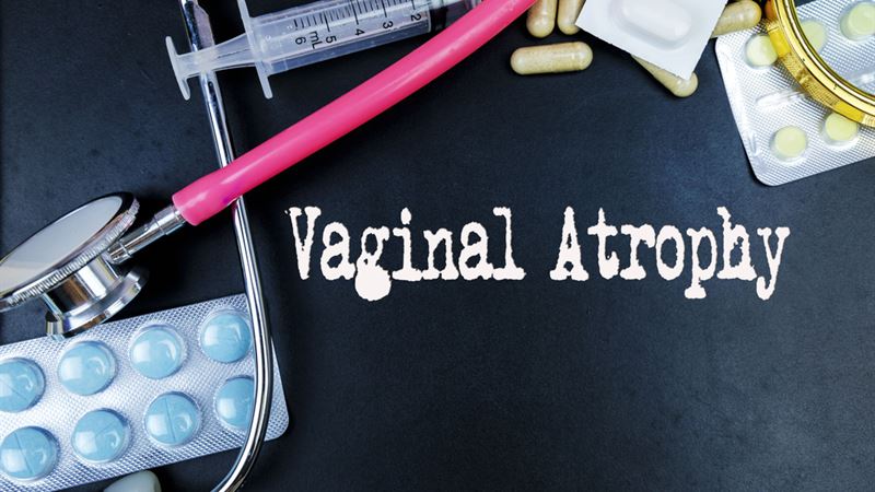 Comprehensive Guide to Managing Vaginal Atrophy After Menopause