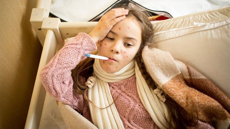 Essential Information About Measles: Symptoms, Causes, and Prevention