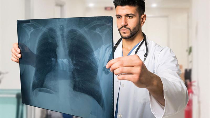 Comprehensive Guide to Pulmonary Fibrosis: Causes, Symptoms, and Treatments