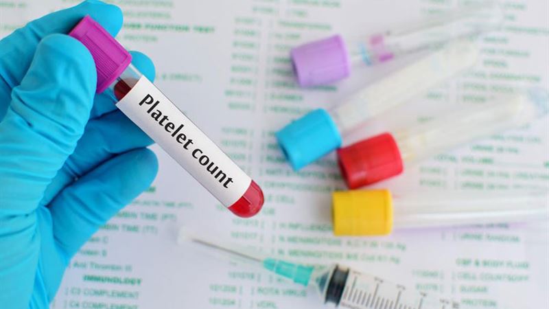 Understanding Thrombocytopenia: Causes, Symptoms, and Comprehensive Insights