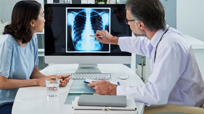 Comprehensive Guide to Recognizing, Diagnosing, and Managing Lung Cancer