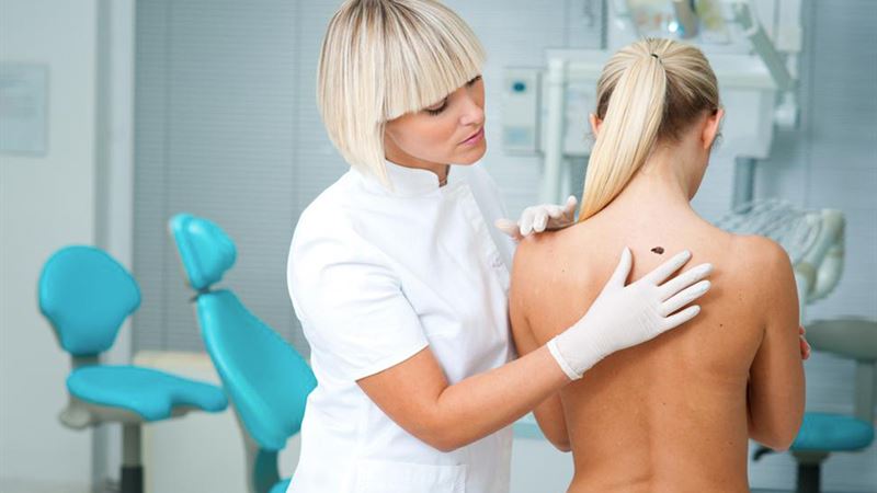 Comprehensive Guide to Advanced Stage Melanoma: Symptoms, Diagnosis, and Treatment Strategies