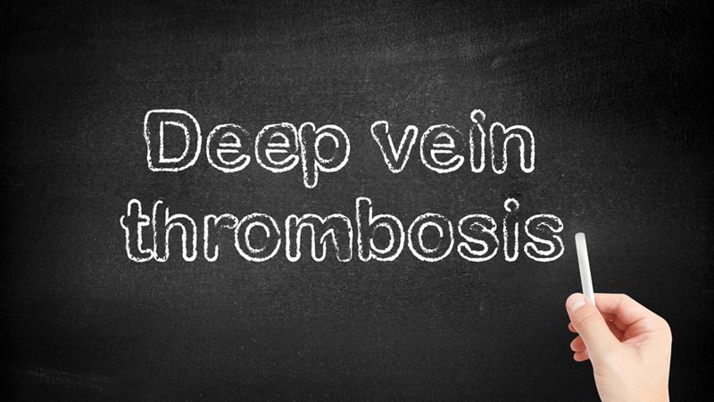 Effective Strategies to Prevent Deep Vein Thrombosis and Maintain Vascular Health