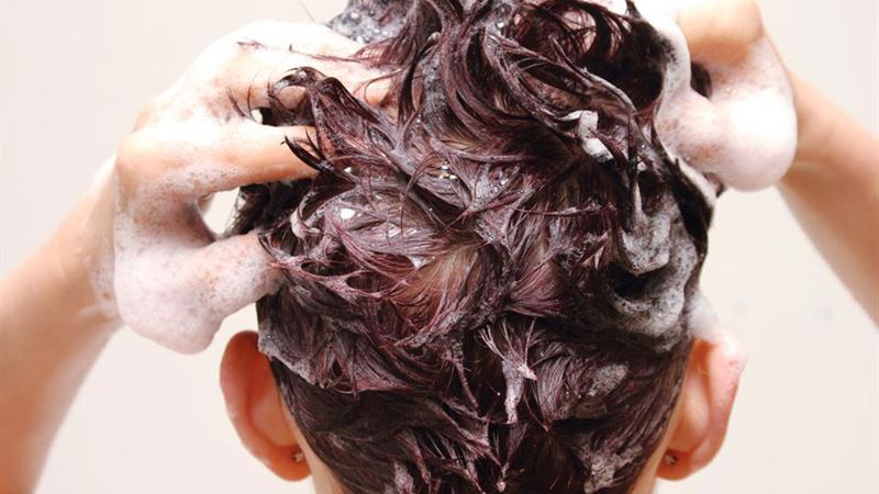 Effective Natural Treatments for Managing Seborrheic Dermatitis on Your Scalp