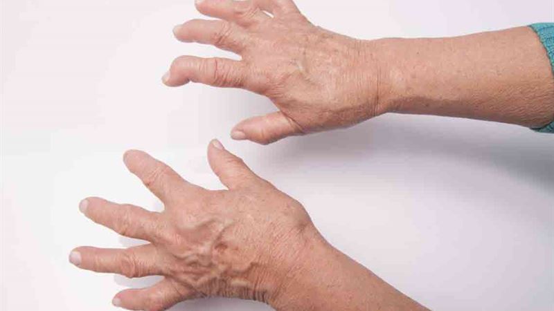 Essential Dietary Guidelines: Foods to Steer Clear of if You're Dealing with Arthritis