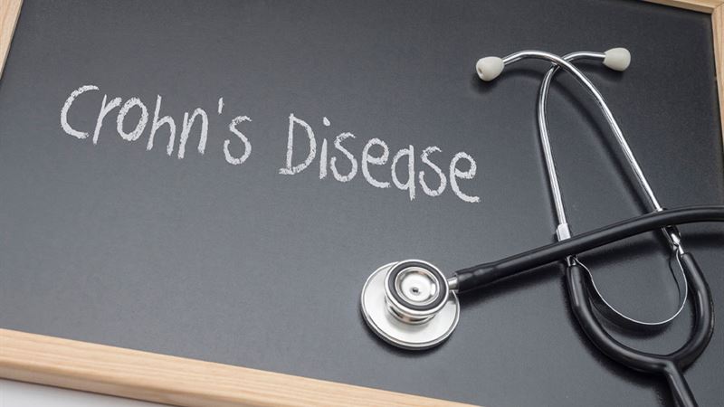 Comprehensive Insights into Crohn’s Disease: Symptoms, Types, and Management Strategies