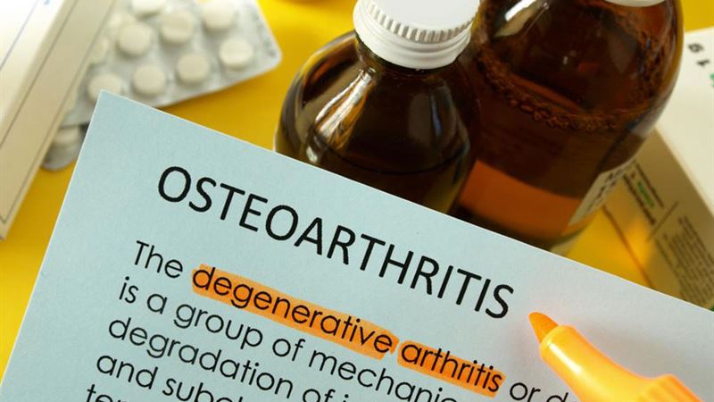Comprehensive Guide to Managing and Treating Osteoarthritis Effectively