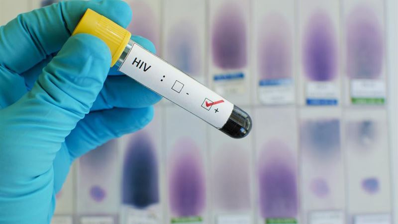 Comprehensive Guide to HIV Testing and Diagnosis Methods