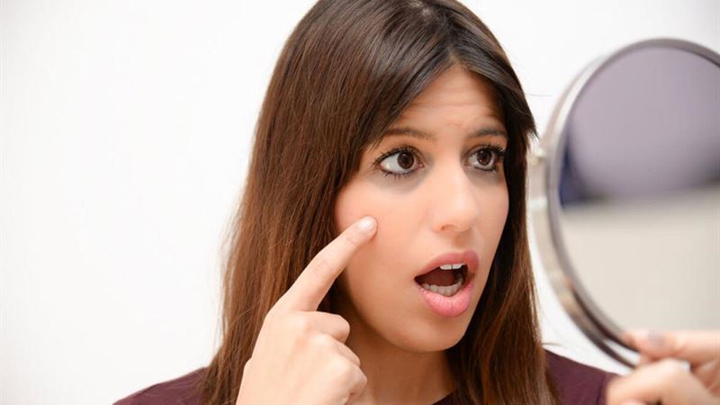 Comprehensive Guide to Effective Dark Circles Remedies You Must Know