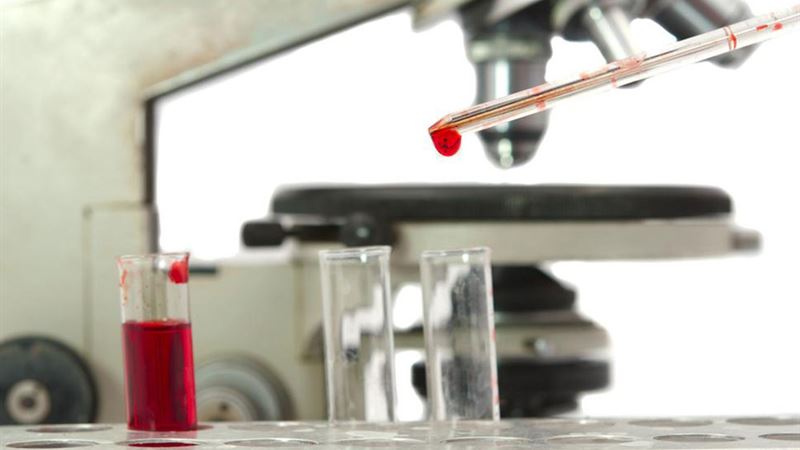 Comprehensive Guide to White Blood Cell (WBC) Count and Its Significance