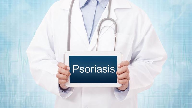Comprehensive Guide to Managing and Treating Plaque Psoriasis