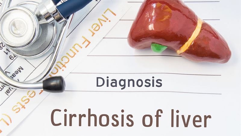 Understanding Liver Cirrhosis: Progression, Prevention, and Management