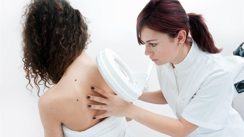 Leverage a Fiber-Rich Diet to Combat Melanoma Effectively