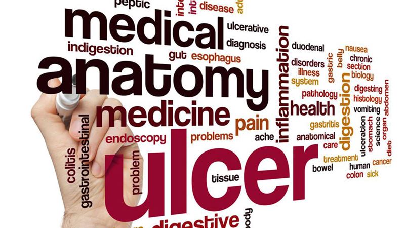 Comprehensive Natural Strategies for Managing Ulcerative Colitis Effectively