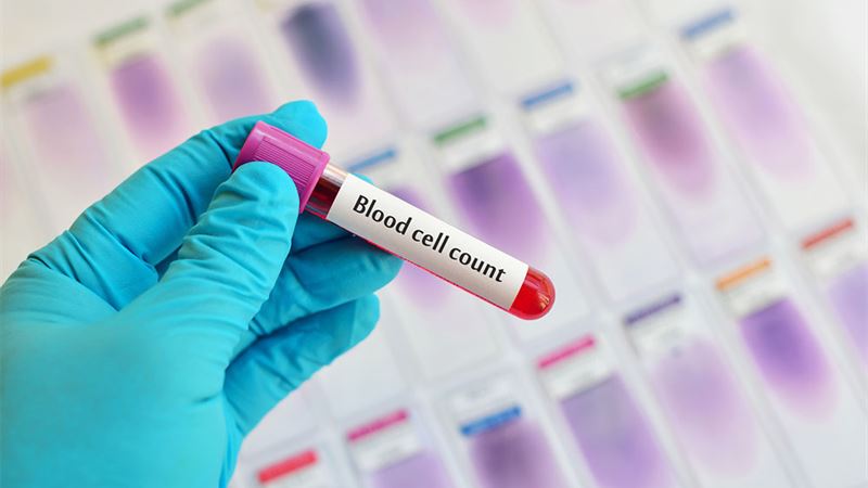Comprehensive Guide to Blood Cell Counts: Understanding Your Blood Health