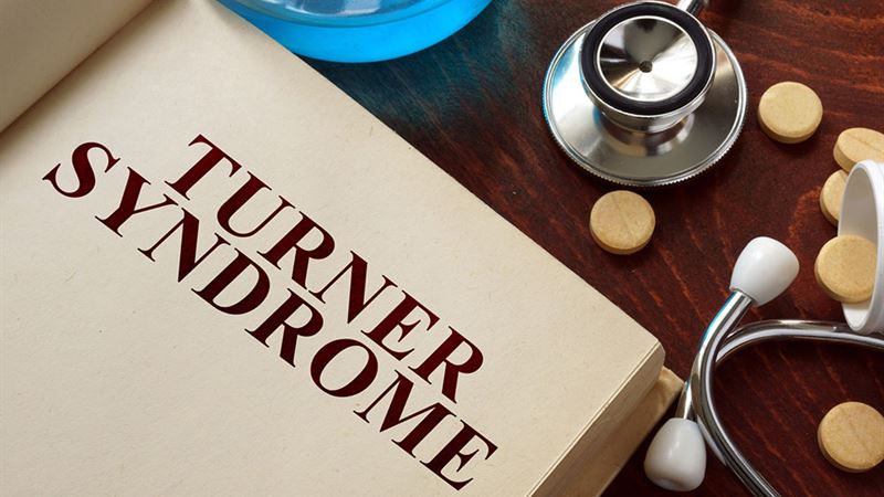 Understanding Turner Syndrome: Causes, Symptoms, Diagnosis, and Management Strategies