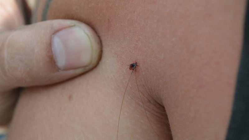 Comprehensive Guide to Detecting and Managing Spider Bites