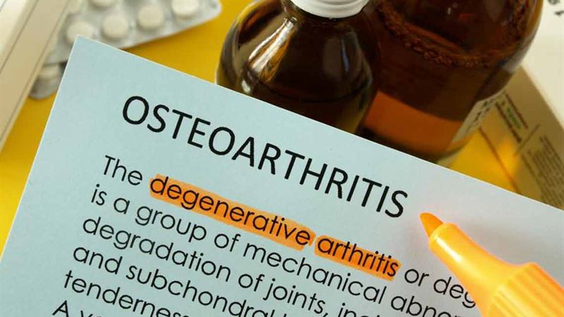 Comprehensive Guide to Managing Osteoarthritis: Causes, Symptoms, and Effective Treatment Options