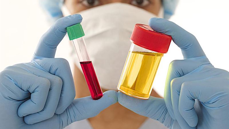 Understanding the Causes of E. coli in Urine Infections: Key Factors and Prevention Strategies