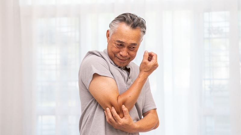 Comprehensive Guide to Recognizing and Managing Psoriasis in Older Adults