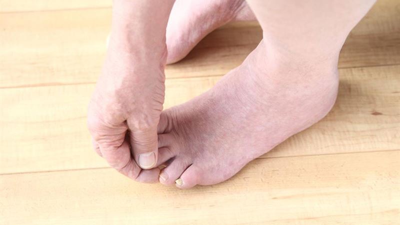 Essential Insights into Toenail Fungal Infections and Prevention Strategies