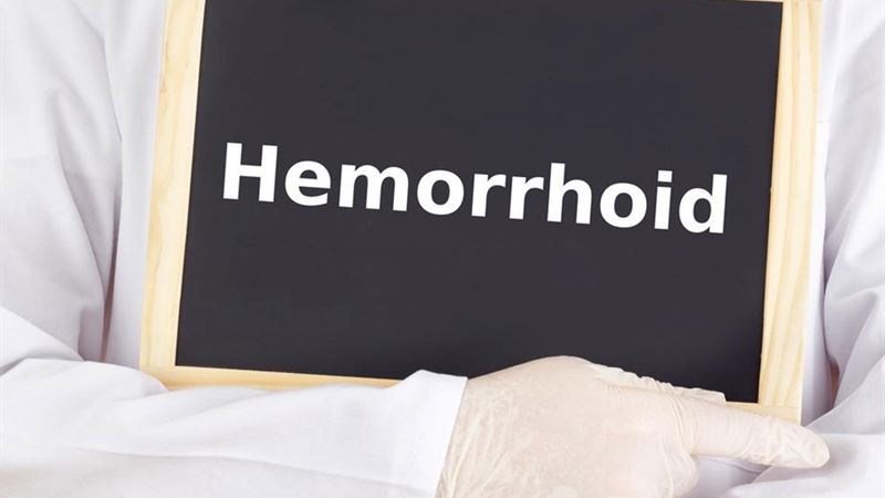 Comprehensive Guide to Effective Hemorrhoid Relief and Treatment Strategies