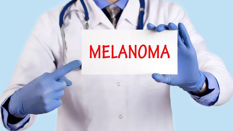 Comprehensive Insights into Metastatic Malignant Melanoma and Its Treatment Strategies