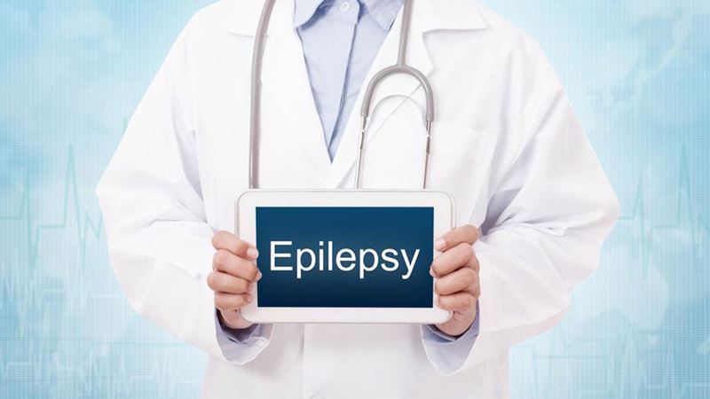 Comprehensive Strategies for Managing and Treating Epilepsy Effectively