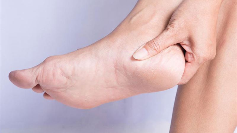 Comprehensive Guide to Heel Pain Relief: Effective Strategies and Treatments