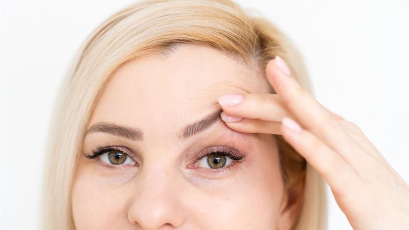 Comprehensive Guide to Surgical and Non-Surgical Treatments for Droopy Eyelids