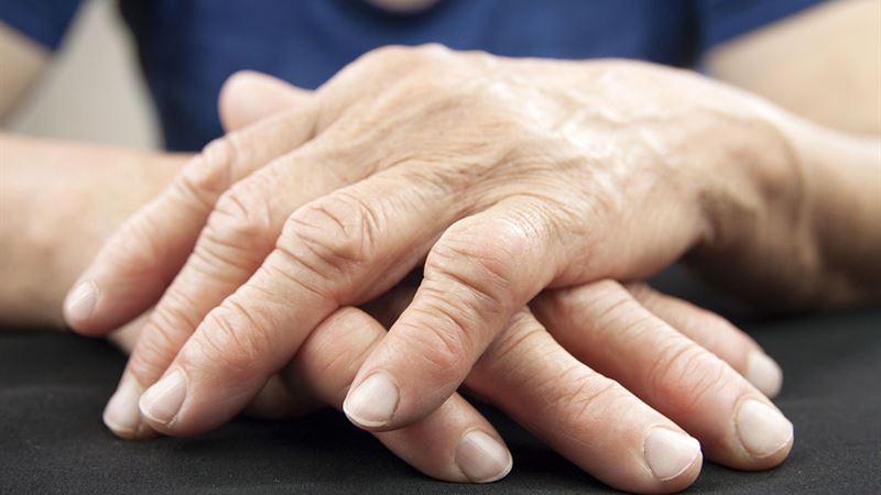 Comprehensive Guide to Diagnosing and Managing Rheumatoid Arthritis