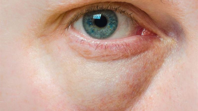 Comprehensive Guide to Managing and Treating Eye Conditions