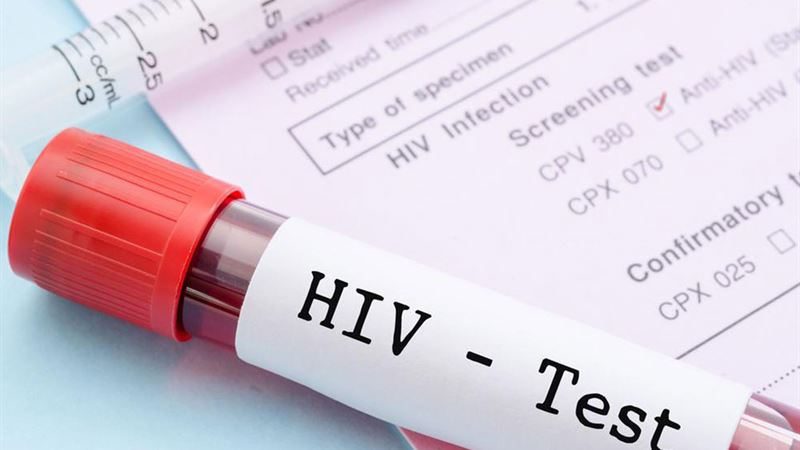 Comprehensive Guide to Understanding HIV and AIDS: Causes, Symptoms, and Prevention