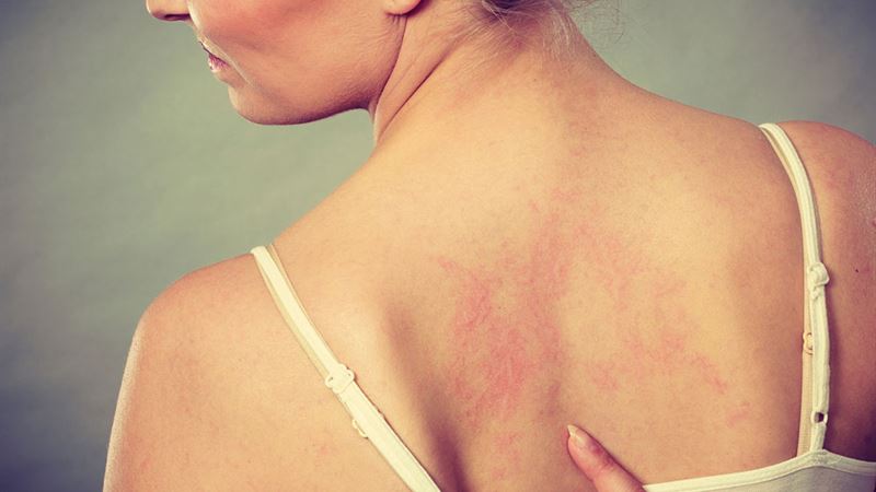 Comprehensive Overview of Skin Conditions and Their Underlying Causes