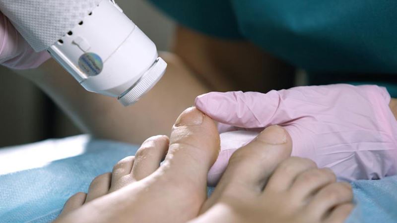 Comprehensive Guide to Effective Remedies for Nail Fungal Infections