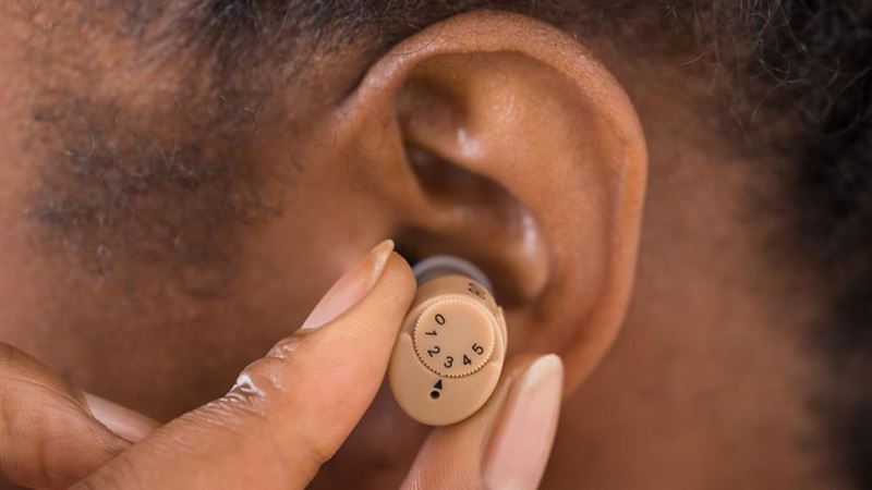 Effective Strategies to Reduce Costs When Purchasing Hearing Aids