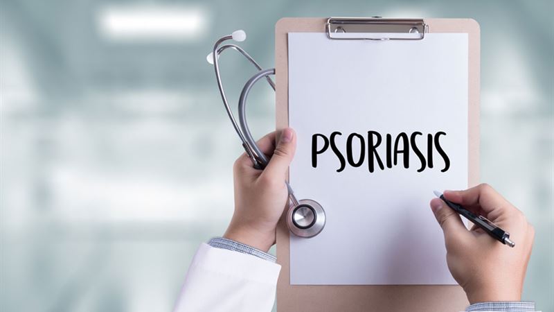 Comprehensive Guide to Managing Psoriasis: Effective Treatment Strategies