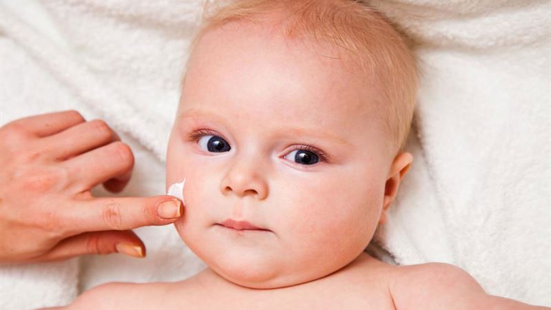 Comprehensive Guide to Infant Eczema: Symptoms, Causes, and Effective Treatment Strategies