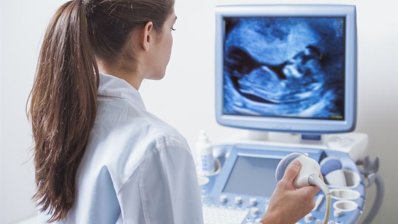 Revolutionizing Healthcare in Mexico with Advanced Ultrasound Diagnostic Technologies