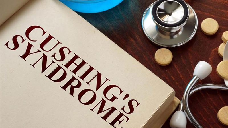 Comprehensive Guide to Recognizing the Signs and Symptoms of Cushing’s Disease